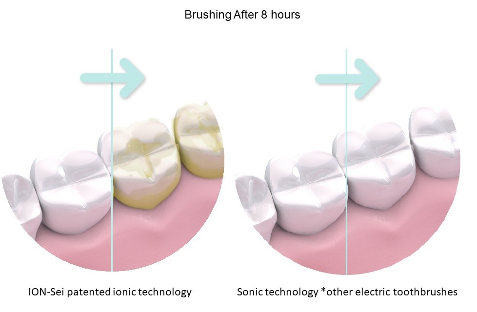 Ion-Sei Ionic Technoly vs Other Electric Toothbrushes